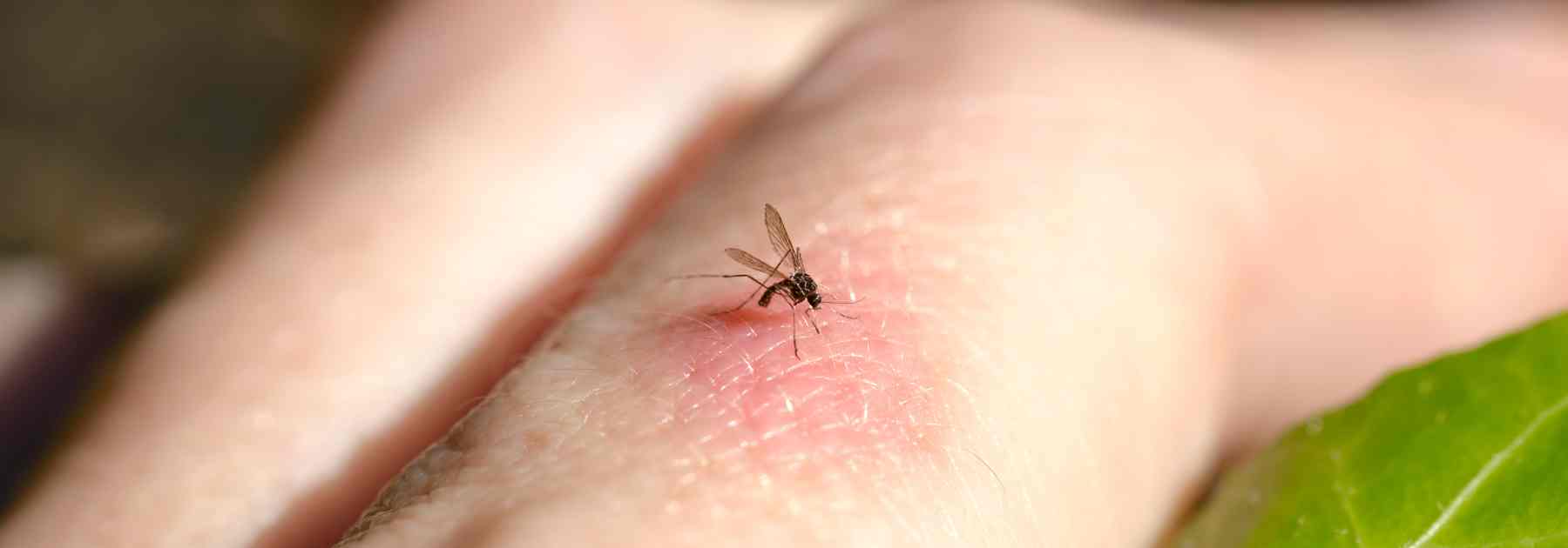 Get infected insect bite treatment in Chelmsford